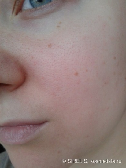Удивительный ВВ крем от Storyderm BB Ecocell Balm