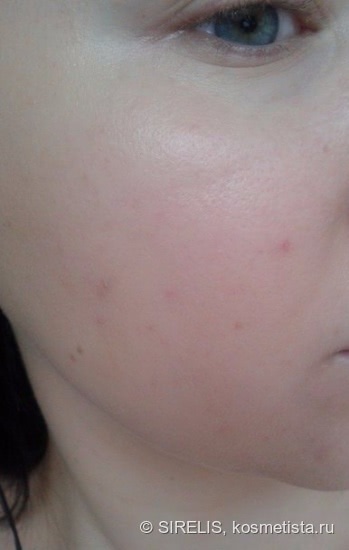 Лечим кожу со Skin Doctors