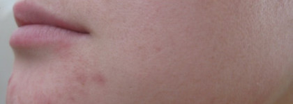 Loccitane Essence Sublime Iris Angelique Serum ― Эссенция для совершенства кожи с ангеликой и ирисом-моя не очень удачная покупка