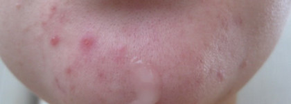 Loccitane Essence Sublime Iris Angelique Serum ― Эссенция для совершенства кожи с ангеликой и ирисом-моя не очень удачная покупка