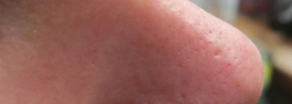 Чистим поры с помощью Ciracle Pore Control Blackhead Off Sheet