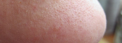 Чистим поры с помощью Ciracle Pore Control Blackhead Off Sheet