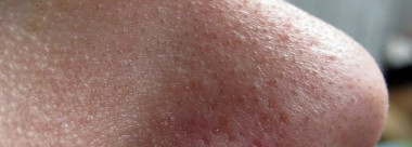 Чистим поры с помощью Ciracle Pore Control Blackhead Off Sheet