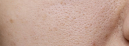 Benefit the Porefessional Probalm to minimize the appearance of pores от Benefit