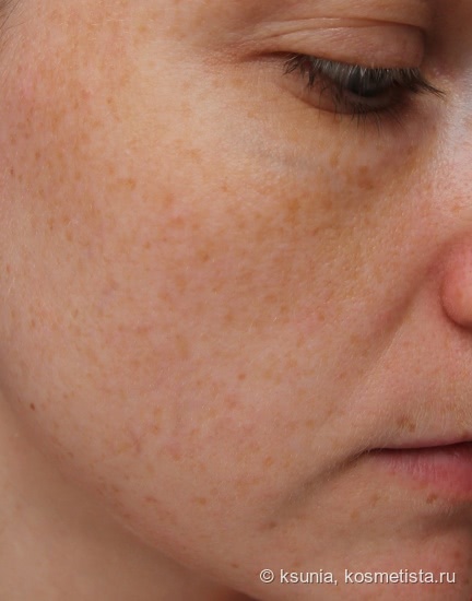 Пилинг с энзимами и фруктовыми кислотами - Abra Therapeutics, Alpha Enzyme Peel (+фото до/после)