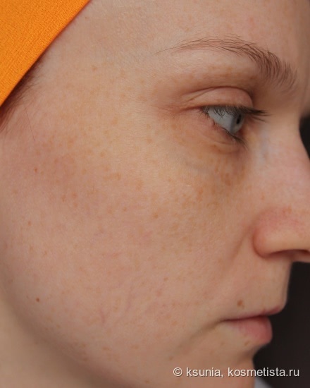 Пилинг с энзимами и фруктовыми кислотами - Abra Therapeutics, Alpha Enzyme Peel (+фото до/после)