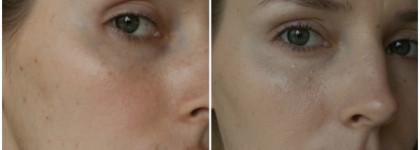 Guerlain Super Aqua-Serum BB+ Hydra Beauty Balm Instant Hydration Perfects SPF 25 PA++ в оттенке Clair/Light