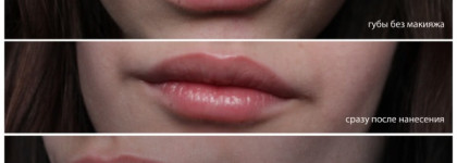 Ода к Almea. Действие первое, Almea Xlips