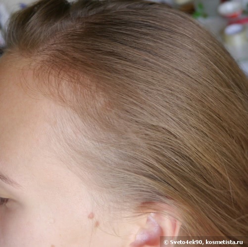 Расти коса, или как восстановить волосы после родов | Отзывы покупателей |  Косметиста