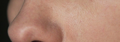 Hot Pink Super Plus Beblesh Balm Skin79