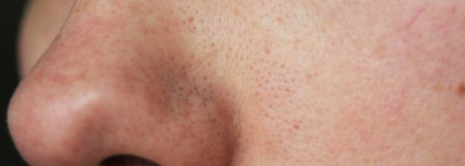 Hot Pink Super Plus Beblesh Balm Skin79