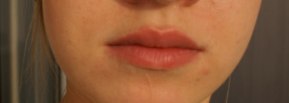 «Мадам, Вам мало в Париже пространства…» или  Guerlain Gloss D`enfer Maxi Shine № #861 Madame Flirte