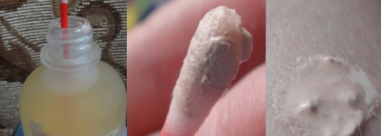 Вечный бой с прыщиками или средства точечного нанесения