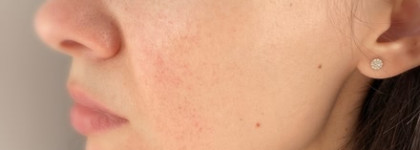 Омолаживающий ББ крем с комплексом из 9 пептидов FarmStay Peptide9 Covering Essence B.B Cream Spf50+/pa++++