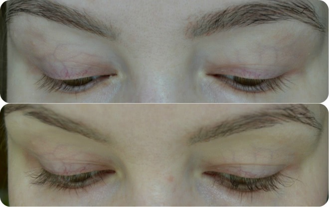 Рассказ о взращивании ресниц вместе с Almea Xlash Serum