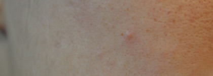 Чудо-пластырь корейского происхождения Skin Food Trouble Clear Spot Patch