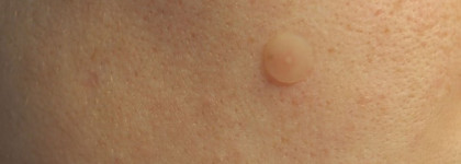 Чудо-пластырь корейского происхождения Skin Food Trouble Clear Spot Patch