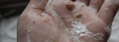 Пара отличников для сухой кожи