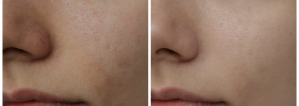 Lumene Bright Now Vitamin C Balancing BB Cream SPF 20 в оттенке 01 Light