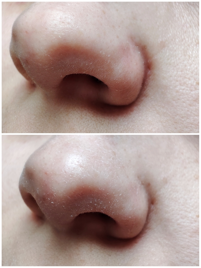 Сверху до, снизу после