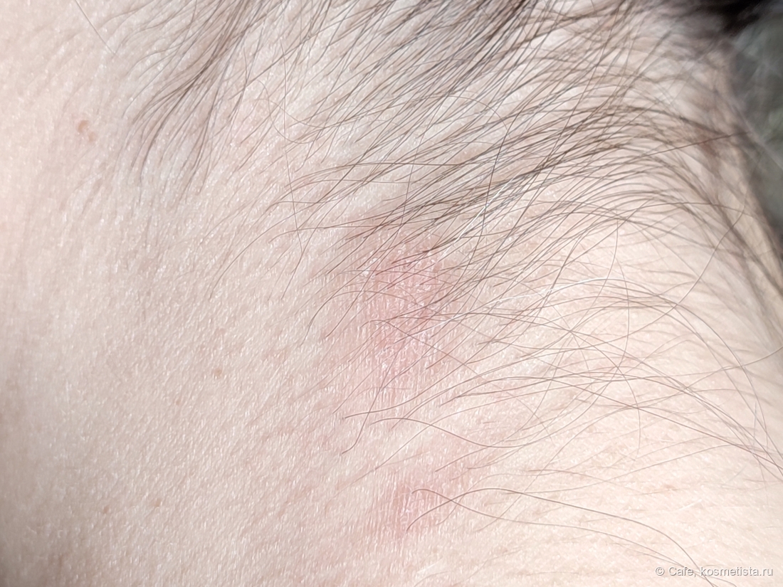 Через 2 недели использования