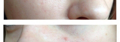 Skin79 Hot Pink Super Plus Beblesh Balm Triple Functions Spf25