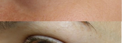 Результат есть! Medik8 Pretox Eyelift anti-ageing four peptide Under-Eye Dark Circle Formula