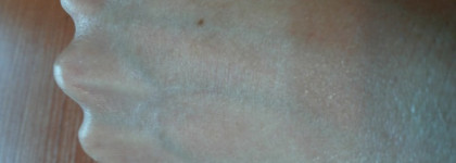 Спасение моей кожи зимой