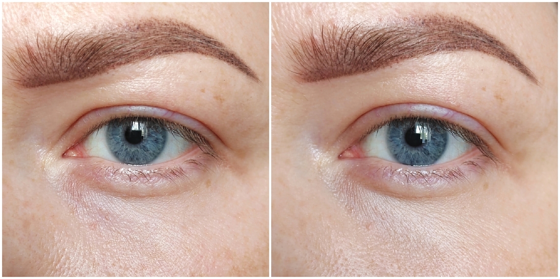 Слева До/справа После.