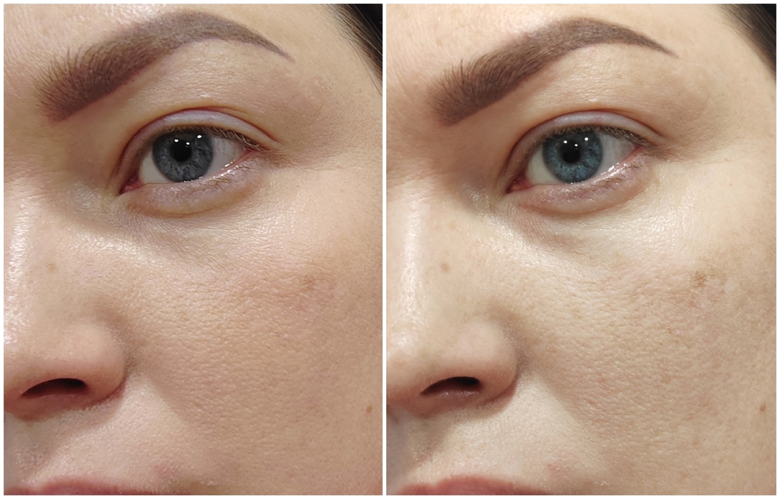 Искусственное освещение. Слева кожа с тональным кремом, справа с пудрой