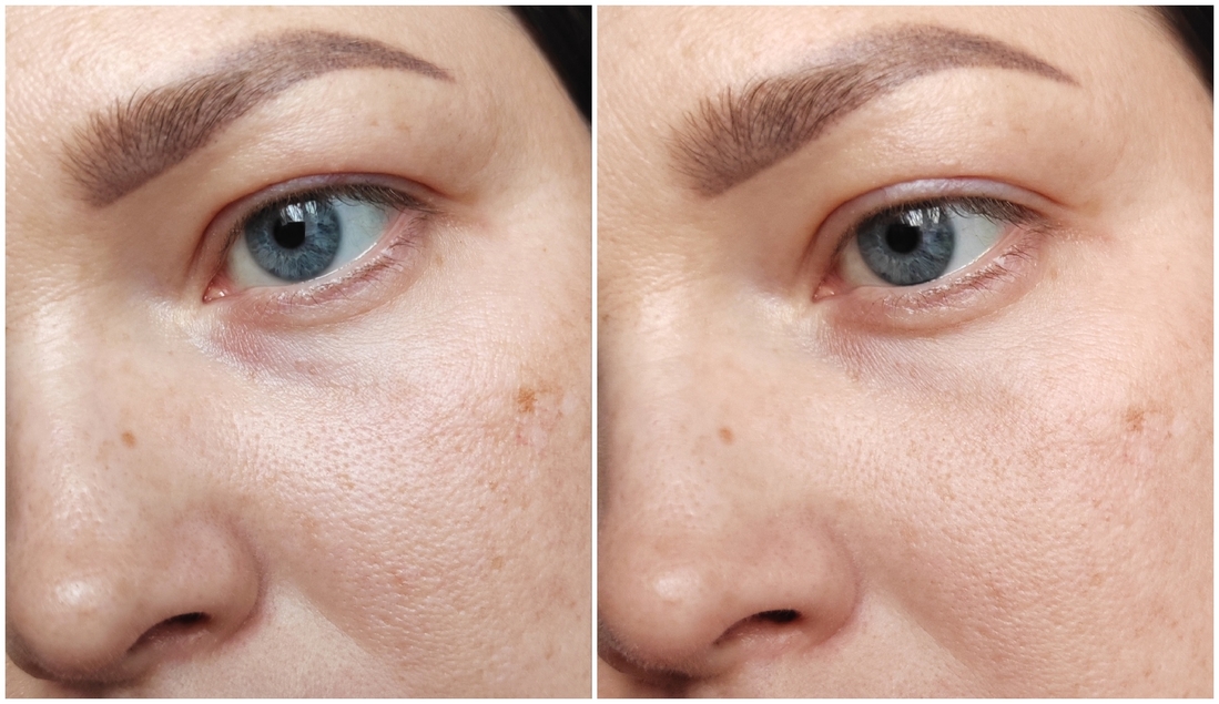 Дневное освещение. Слева - чистая увлажненная кожа, справа - припудренная