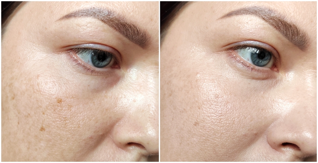 Чистая увлажненная кожа/тонированная эмульсия