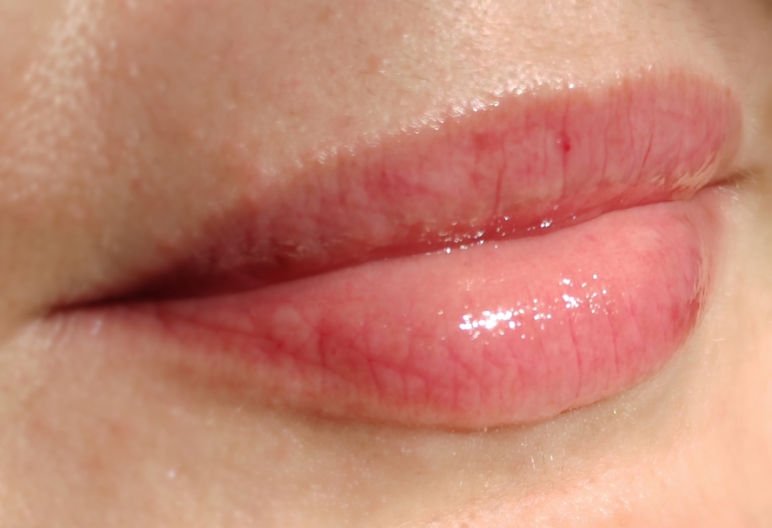 Прямой солнечный свет