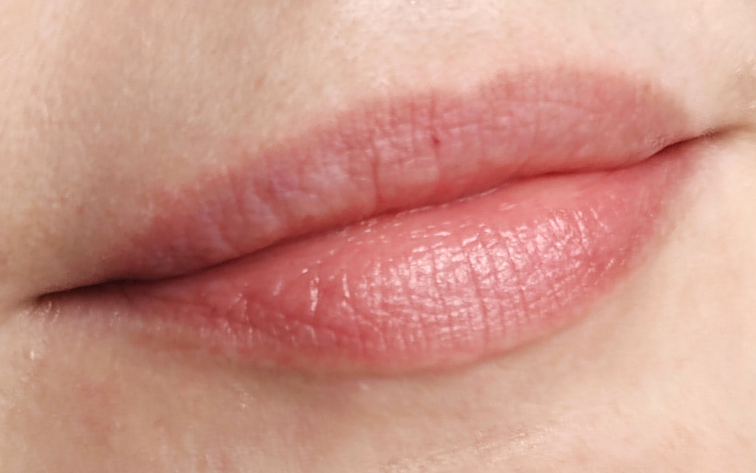 Губы ДО