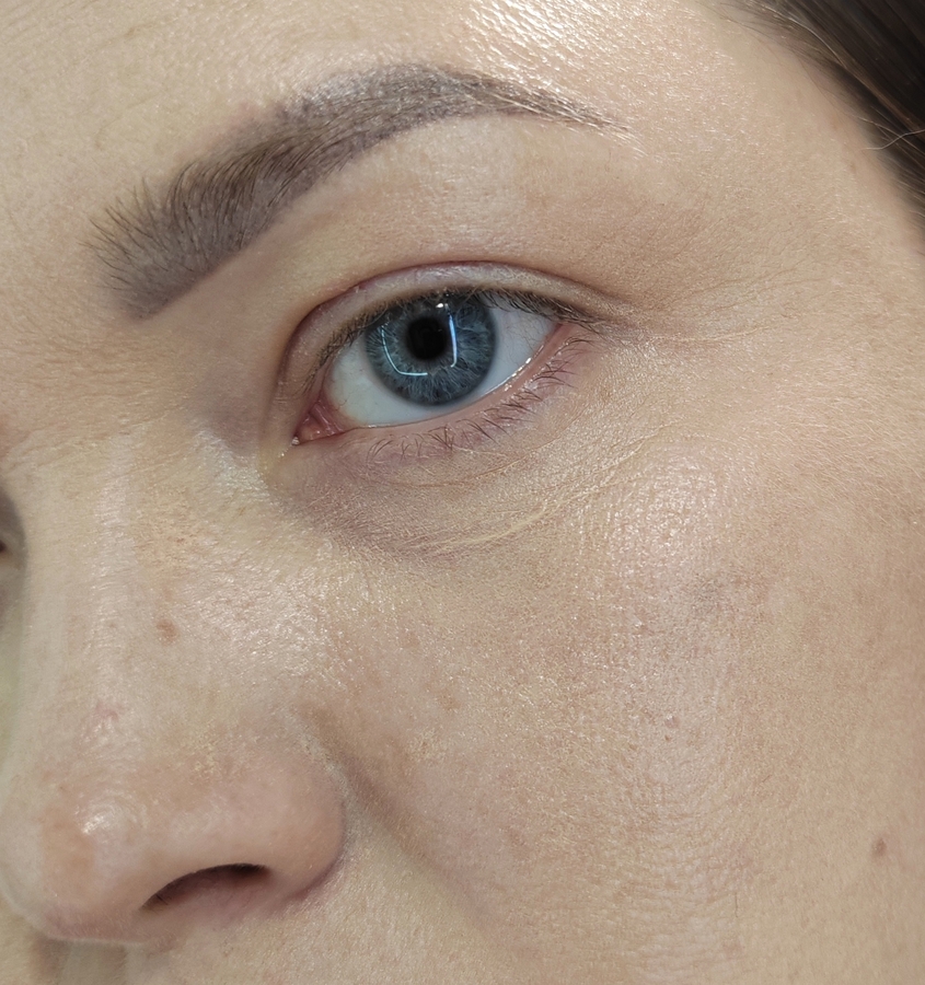 Через 5 часов. Крем собрался во все морщинки, какие есть на коже. Местами он вообще исчез