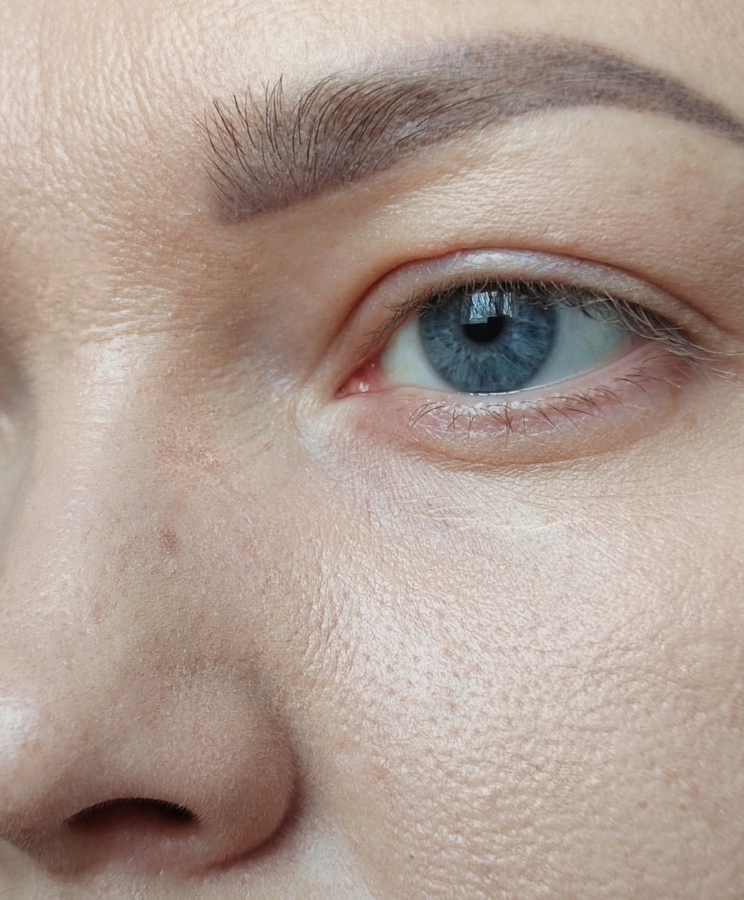 Через 2 часа. Крем начинает подчёркивать места сухости кожи в области носа. Под глазами крем собирается в морщинки. И проваливается в поры...