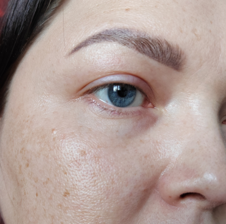 Чистая кожа