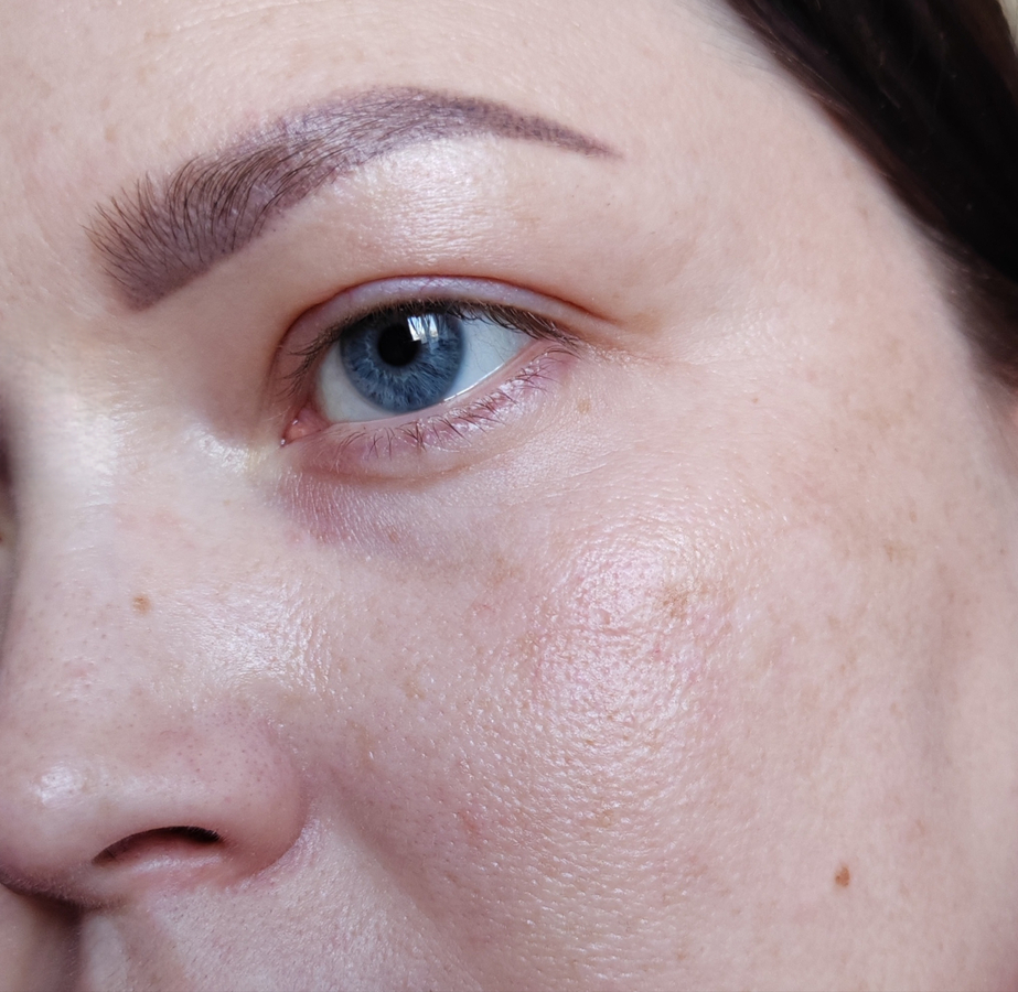 Чистая кожа.