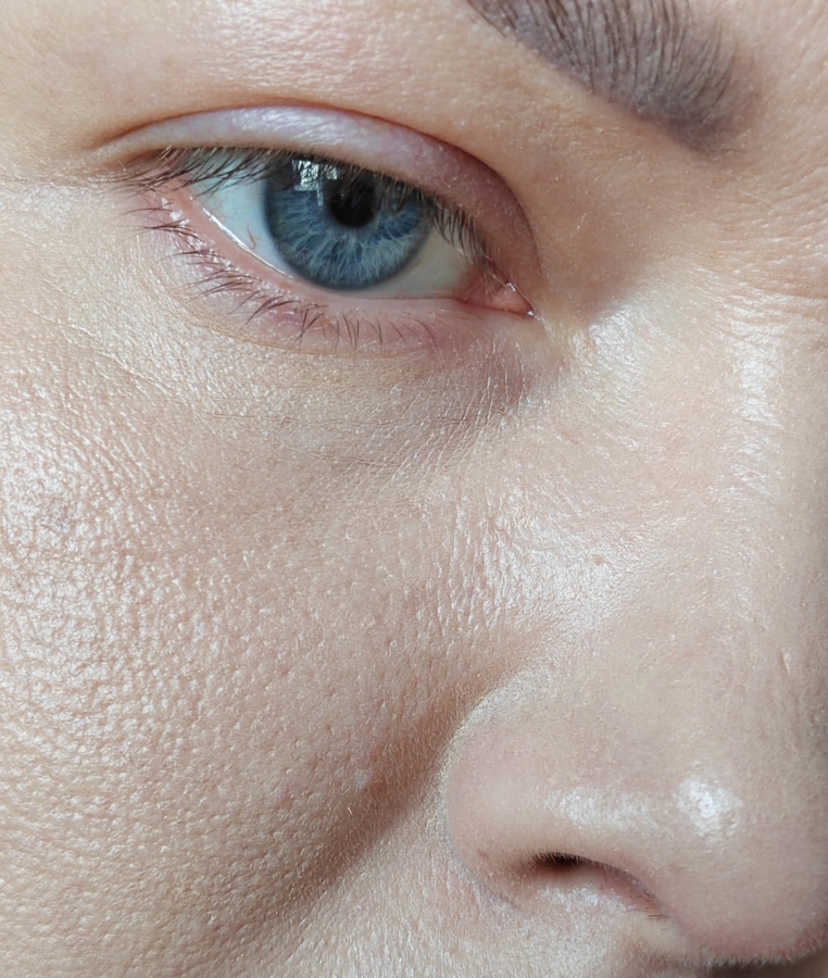 Через 1 час пигмент начинает оседать в порах, подчёркивая их