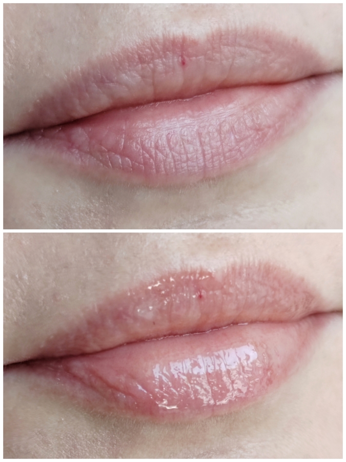 Губы ДО / После, с 1 слоем масла. Дневное освещение, на улице пасмурно