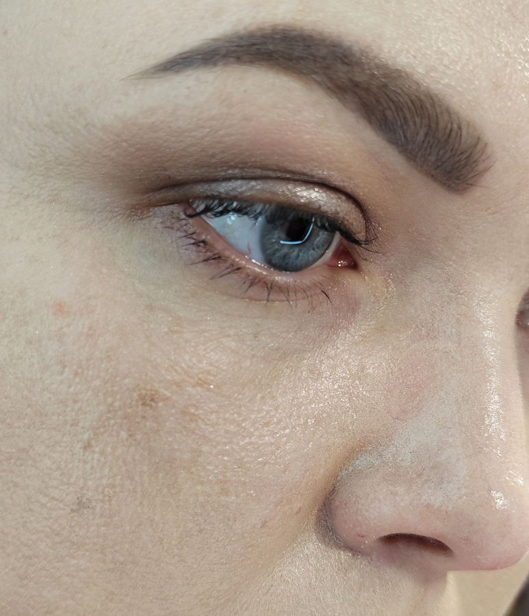 Искусственное освещение. Через 3 часа. Кожа блестит. Тон и пудра собираются во всех складках кожи. На переносице, от очков, через 15 минут остались проплешины