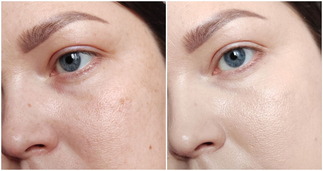 Слева - чистая кожа (увлажненная), справа - нанесён тональный крем с помощью сухого спонжа