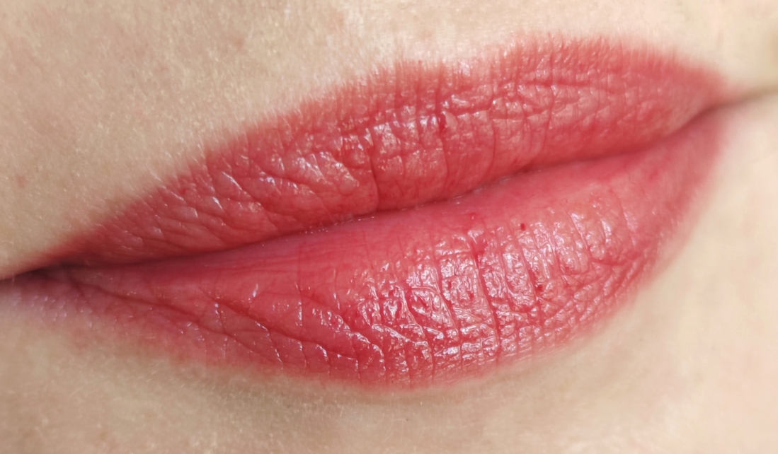 Цветной пигмент подчёркивает сухие участки