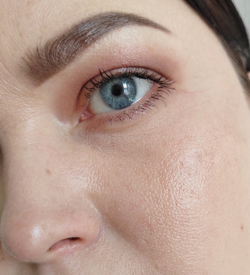 Через 2 часа. Дневное освещение. Тон с пудрой забивается в морщинки, в поры