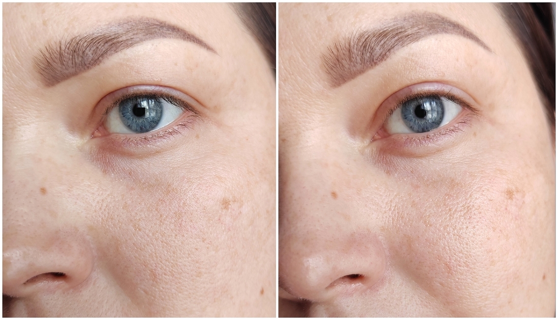 Слева - чистая кожа, справа - нанесён крем