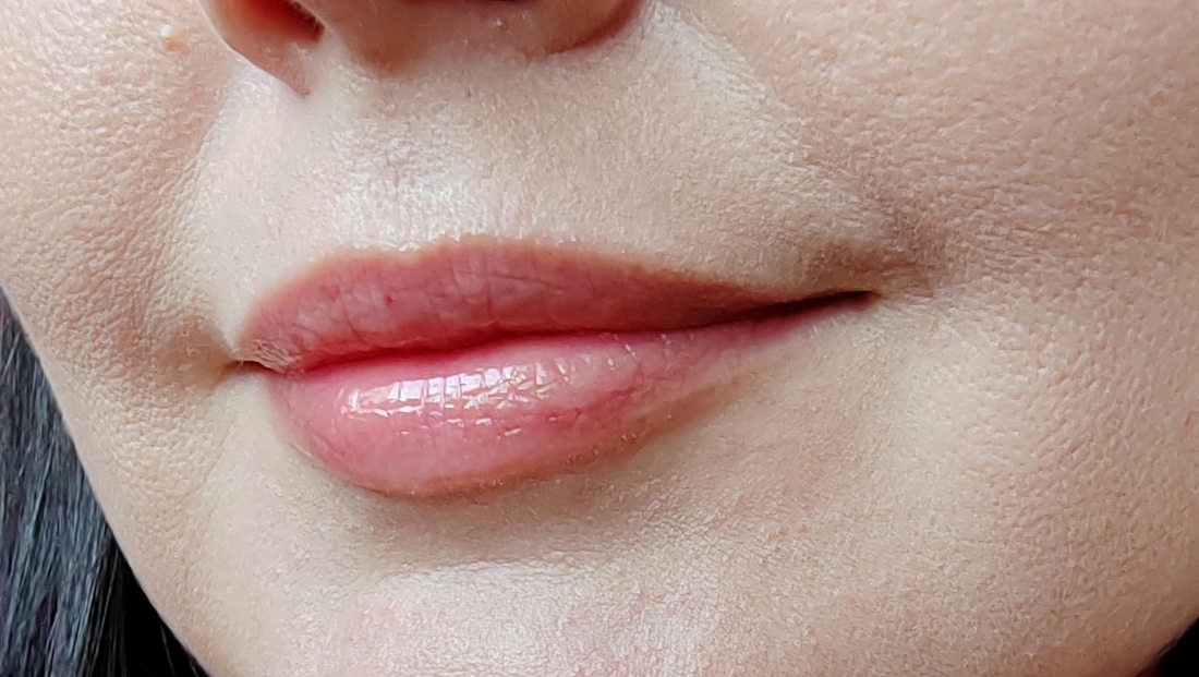 Через 1 час. Кожа выглядит дряблой, рельефной. Морщинки и заломы визуально подчеркнуты