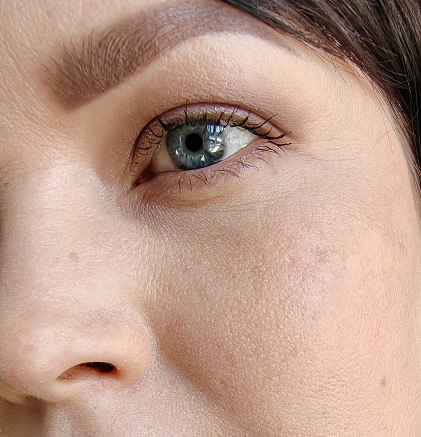 Через 6 часов после нанесения. Благодаря салфетками, видимый блеск с кожи ушёл, НО кожа на вид стала сухая, с резко обозначеным рельфом. Кожа, словно в точечку... Вживую это ещё хуже выглядит