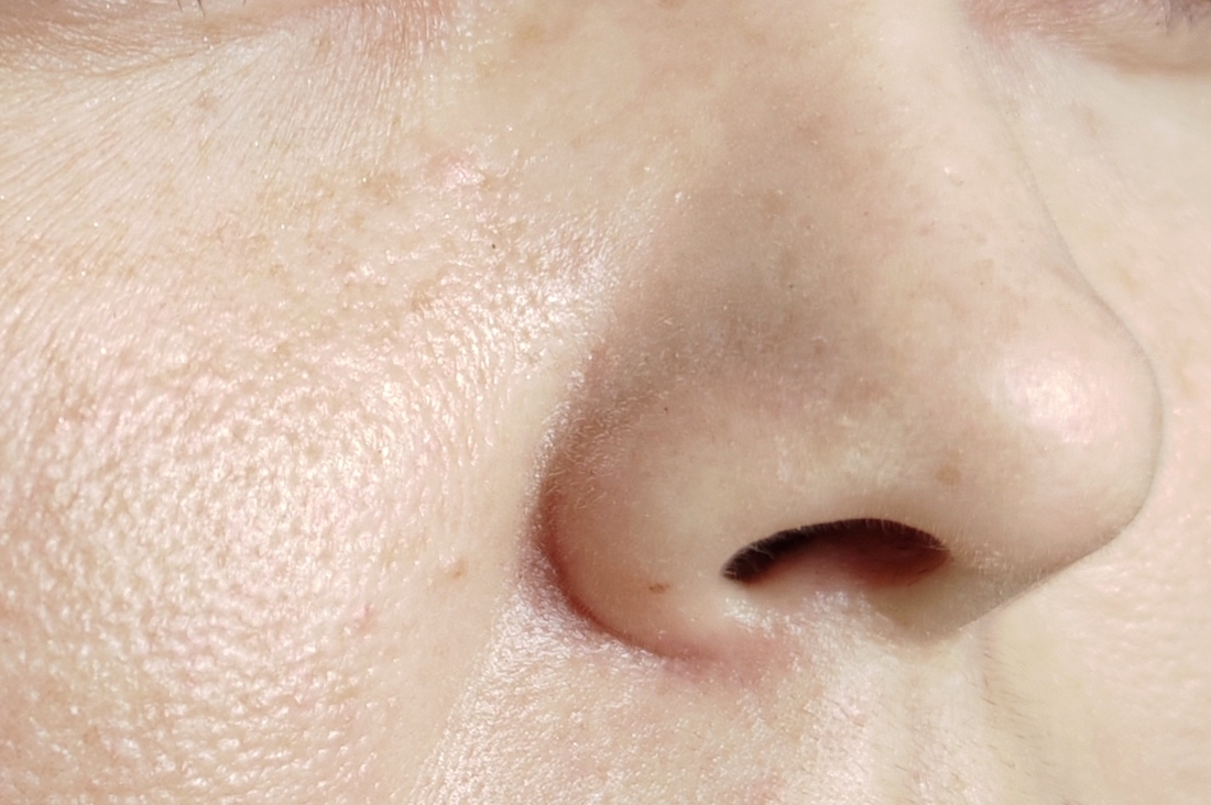 16-00. Тон не собирается в труднодоступных местах, таких, как например, возле носа