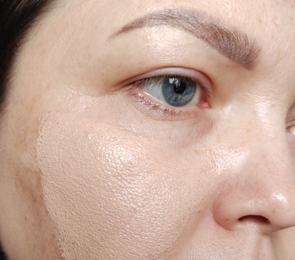 На этом фото прекрасно видно, как пигмент основы подошёл к моему цвету кожи, и лишь в местах, где пигментные пятна темнее, виден их контраст. Основа слегка приглушает пигментацию, но полностью не перекрывает