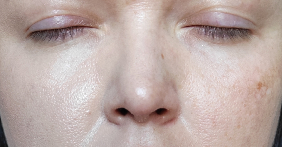 Слева - тональная основа, справа - чистая кожа.